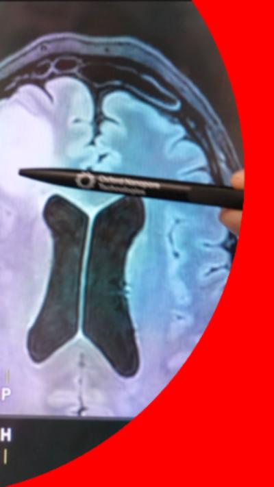 A person looking at an image of a brain on a computer screen with another person pointing at it with a pen.