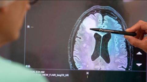 A person looking at an image of a brain on a computer screen with another person pointing at it with a pen.